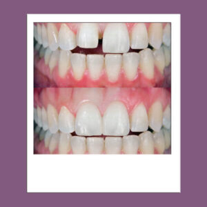 DENTAL CARE VARIOS 600 X 600 WEB LUMIDENT (1)