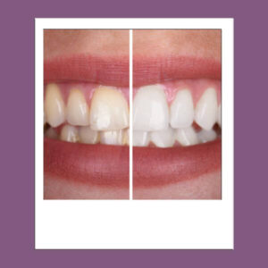 DENTAL CARE VARIOS 600 X 600 WEB LUMIDENT (3)