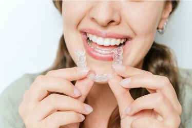 invisalign