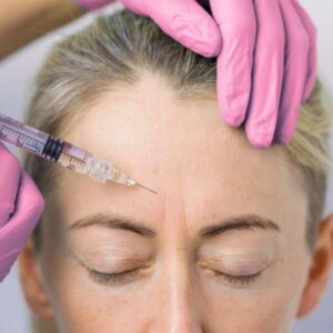 botox cheek filler lumident (11)