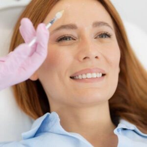 botox cheek filler lumident (13)