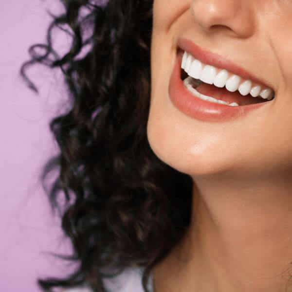 carillas dentales - Lumident